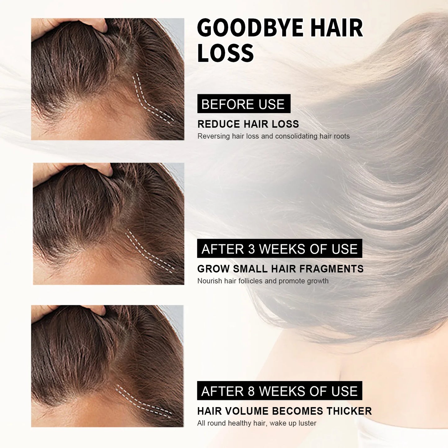 Anti Dandruff Hair Shampoo