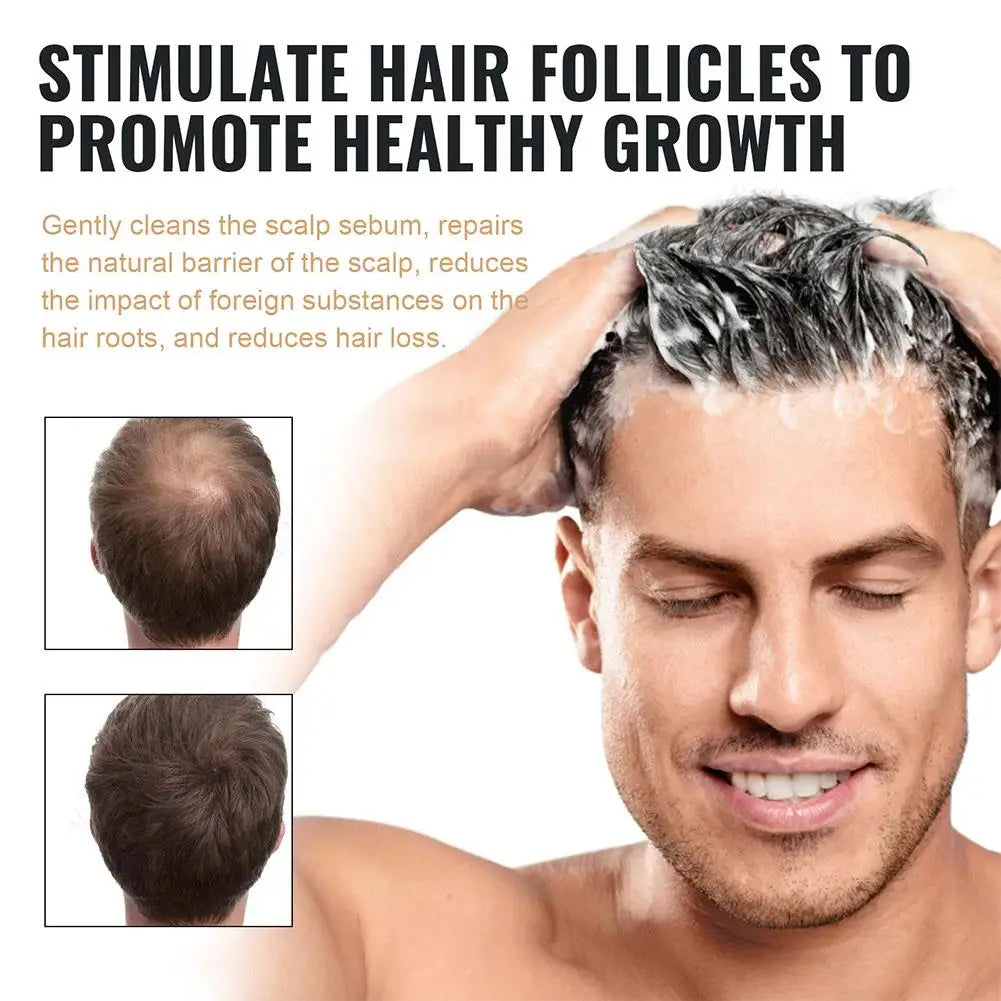 Hair Loss Repair Shampoo
