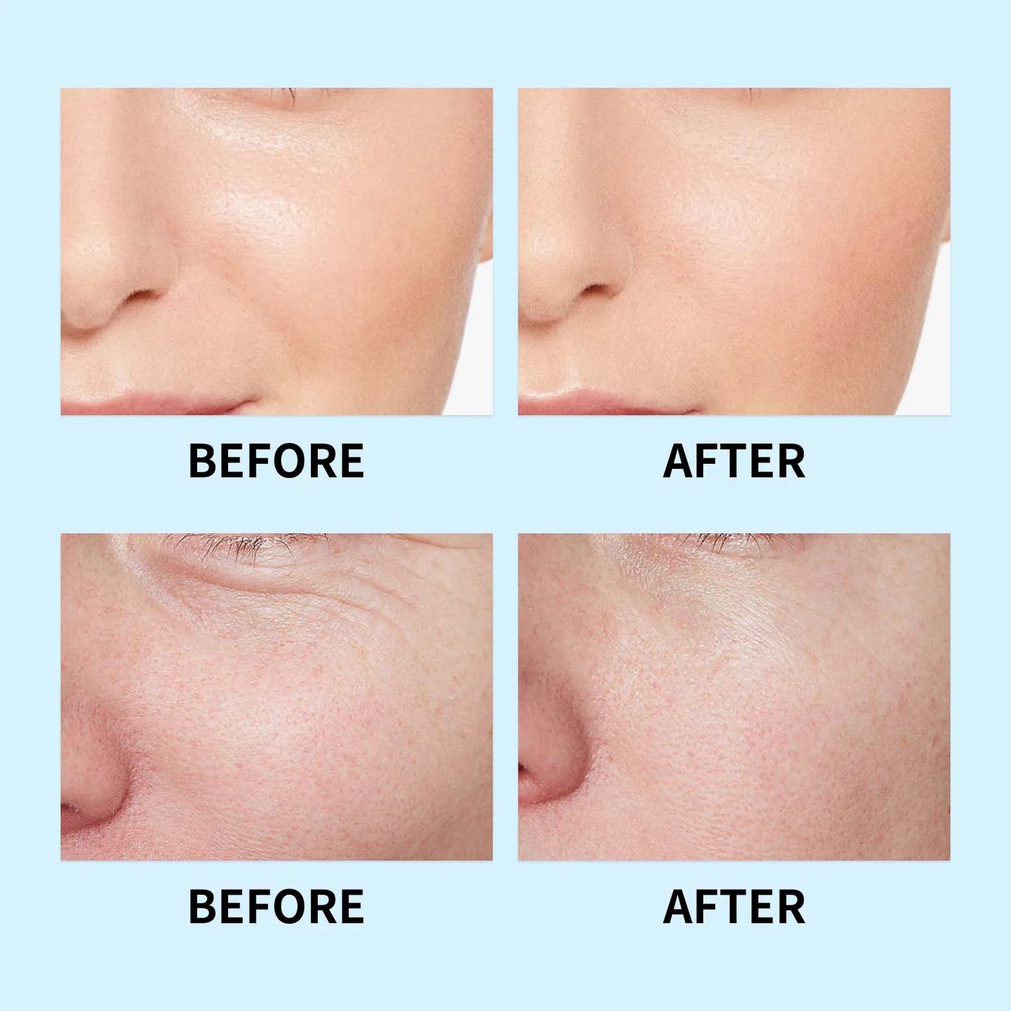 Hyaluronic Lifting Serum