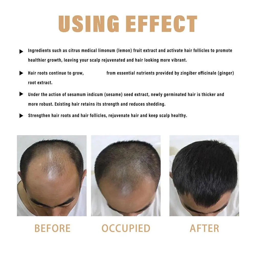 Hair Loss Repair Shampoo